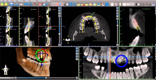 Studio Dentistico Dr Franco Milaneschi | Software 3D