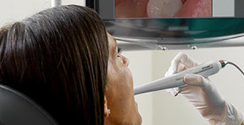 Studio Dentistico Dr Franco Milaneschi | Telecamera intraorale